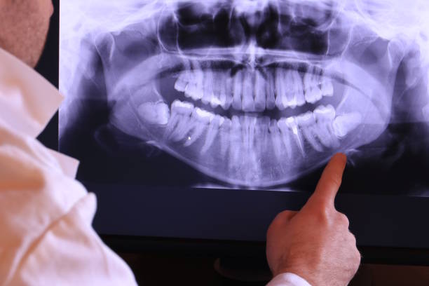 Best Emergency Tooth Extraction in Golden Beach, MD