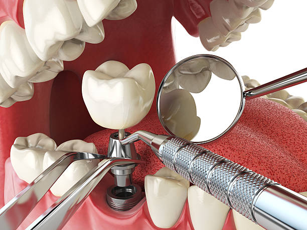 Best Emergency Dental Care for Trauma or Injury in Golden Beach, MD